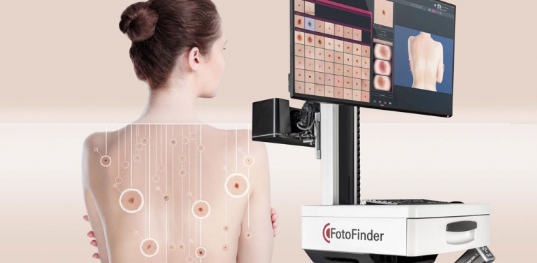 FotoFinder Systems Case Study - Sellmore